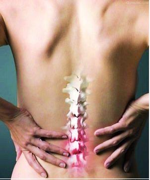 做好强直性脊柱炎与类风湿疾病相鉴别