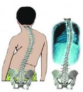 强直性脊柱炎的身体会出现哪些症状