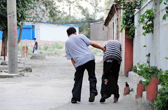 从哪些方面可以体现强直性脊柱炎 从哪些方面可以体现强直性脊柱炎