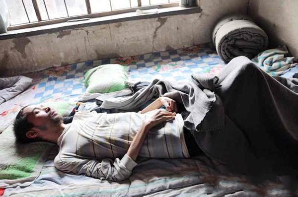 患上强直性脊柱炎后有哪些明显的病症 患上强直性脊柱炎后有哪些明显的病症